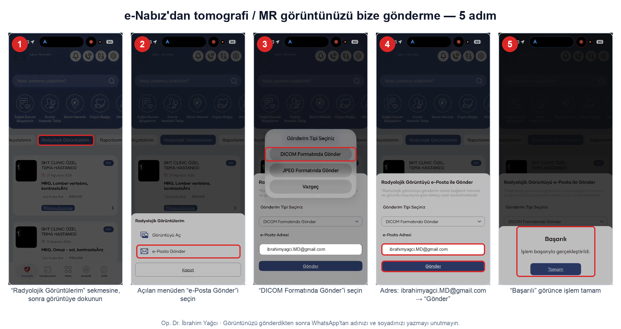 e-Nabız görüntü gönderme adımları
